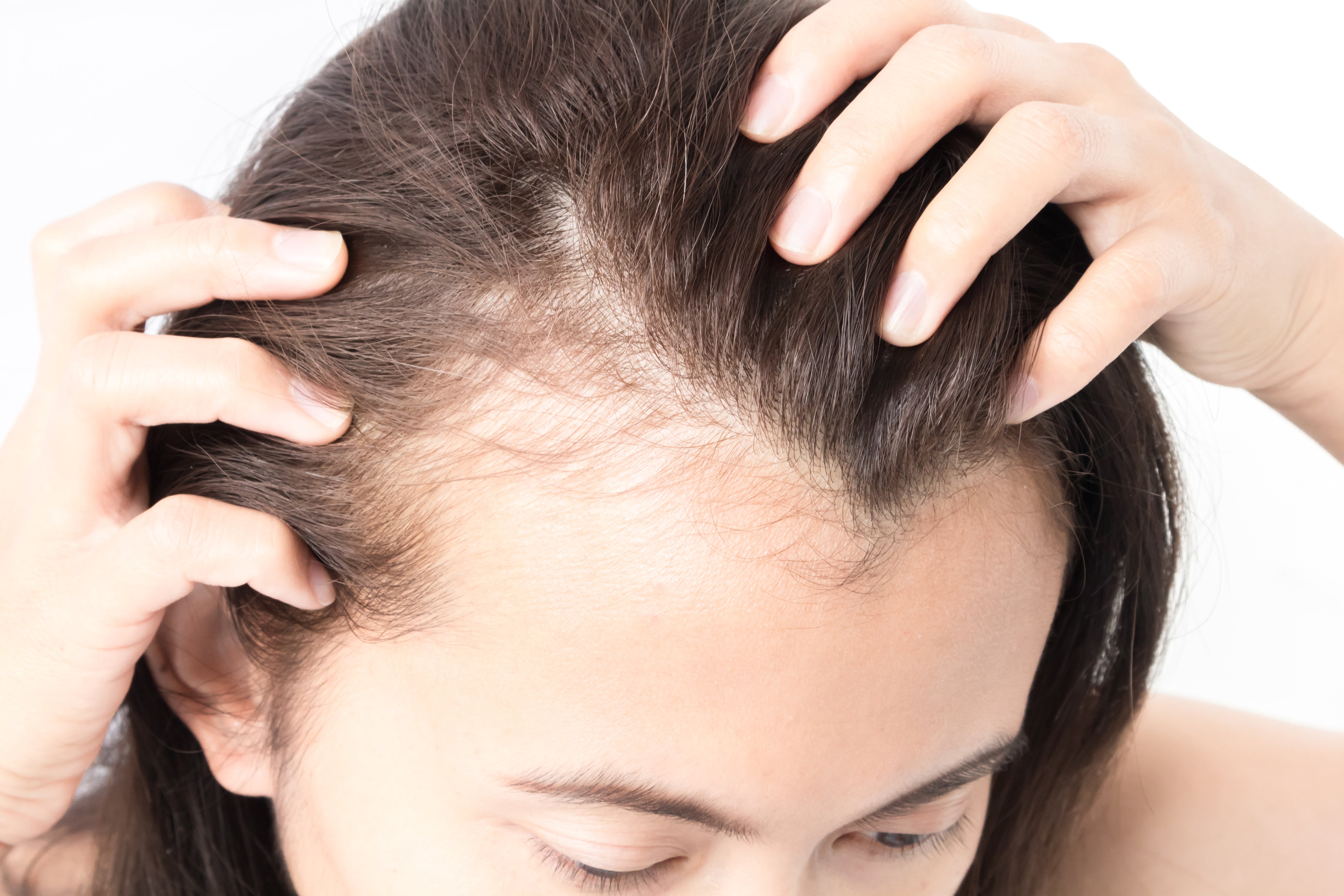 Hair Loss Solution: Dry Scalp Serum