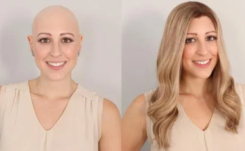 Hair Loss Solution: Chemo Luxury Wigs